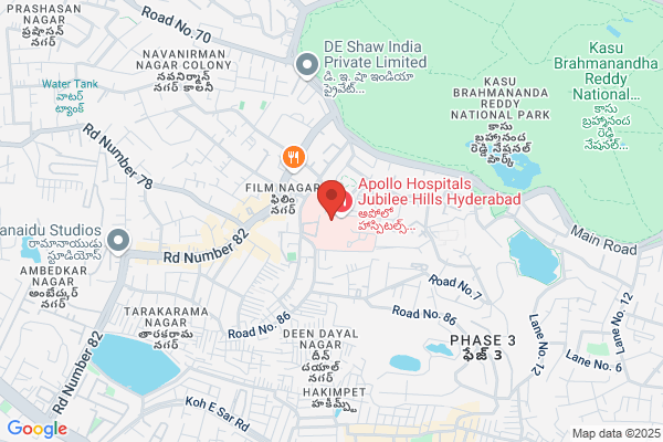 DR. Suresh Giragani | Interventional Radiologist in Hyderabad