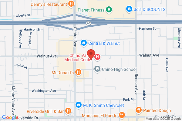 Advanced Eyecare of Chino Optometry