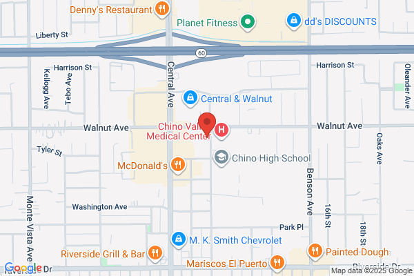Advanced Eyecare of Chino Optometry
