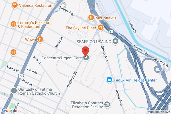 Elberon Development Co