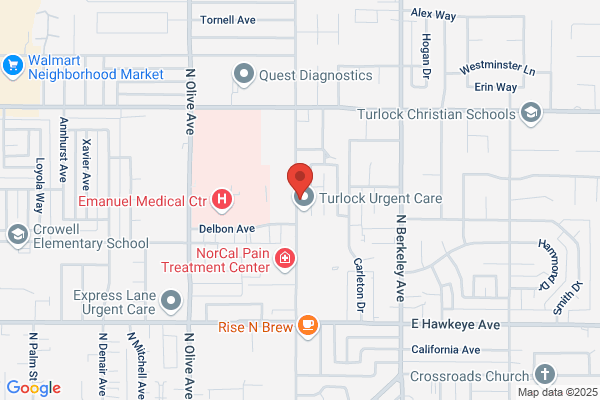 Turlock Eyecare Opt. Corp.