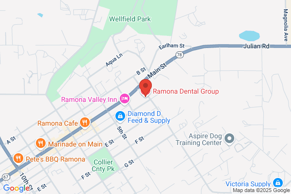 Ramona Dental Group- D. Bruce Laurie DMD