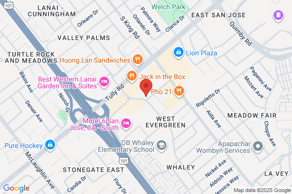 I-LIPO LASER SAN JOSE