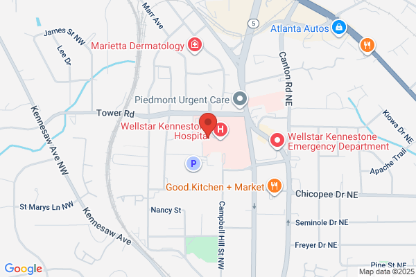 Wellstar Radiation Oncology